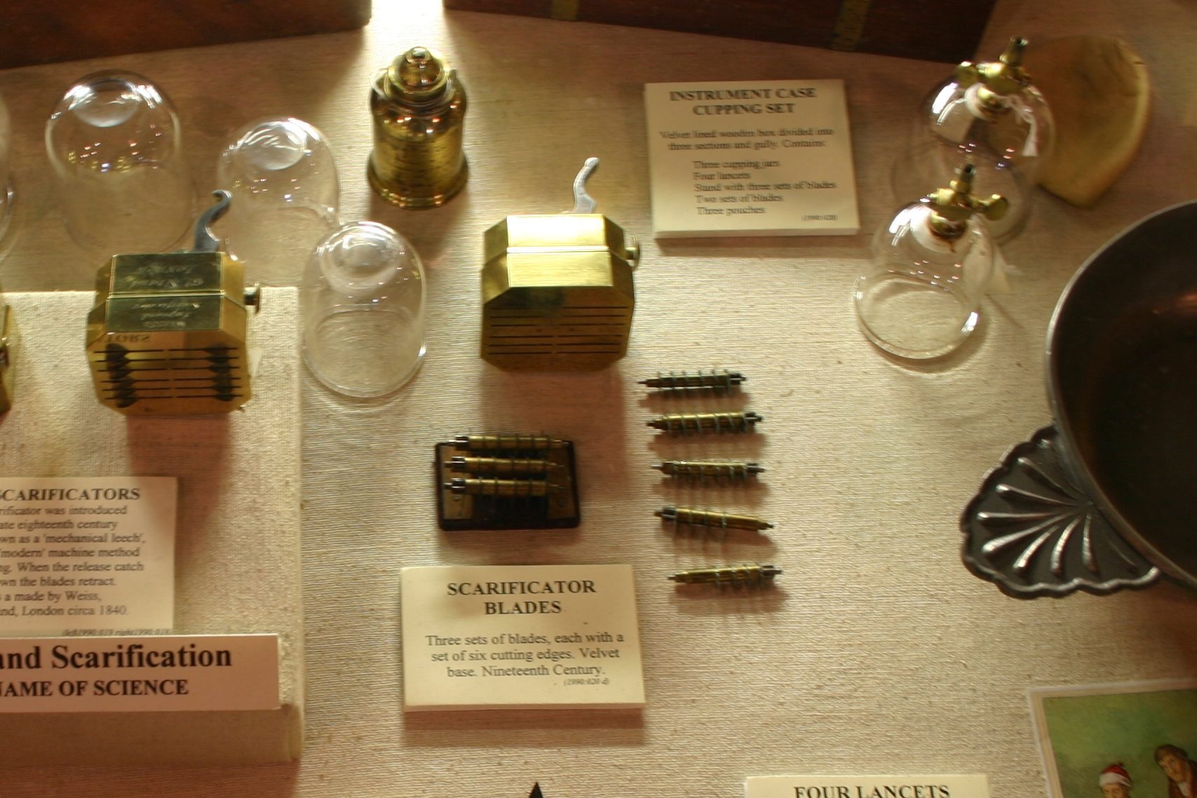 Cupping and scarification, Old Operating Theatre & Herb Garret, London - 03.JPG